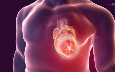 Bradycardias, Tarchycardias, Myocardial Ischaemias (MIS) CME